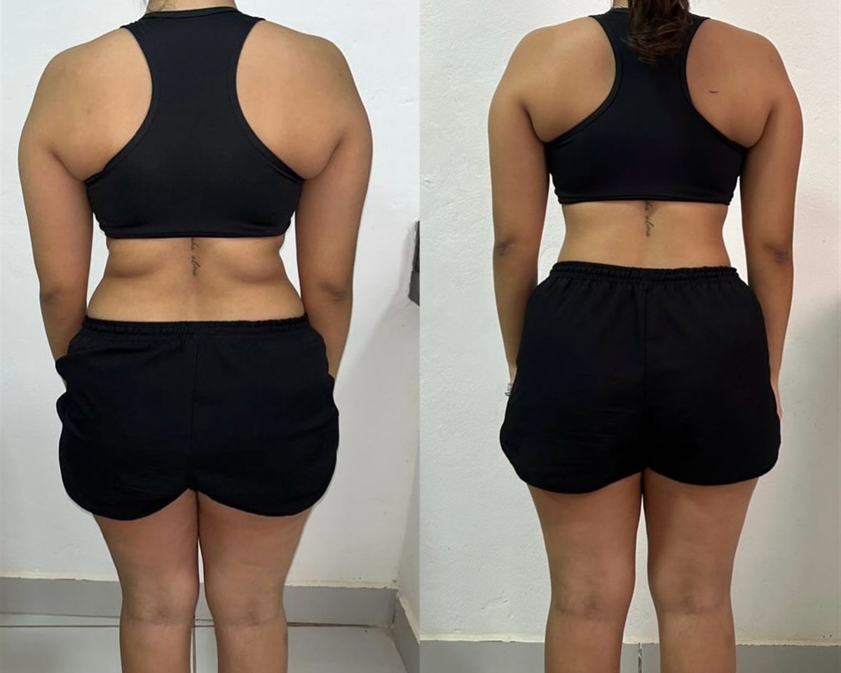 Antes e depois de aluna do Gustavo